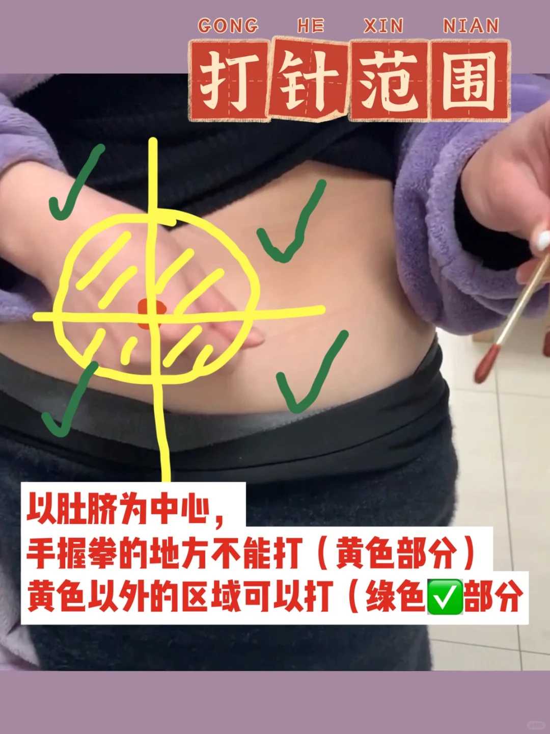 广州代怀生个儿子_100%安全包成功,广州医院试管可以做双胞胎吗？广州做试管可