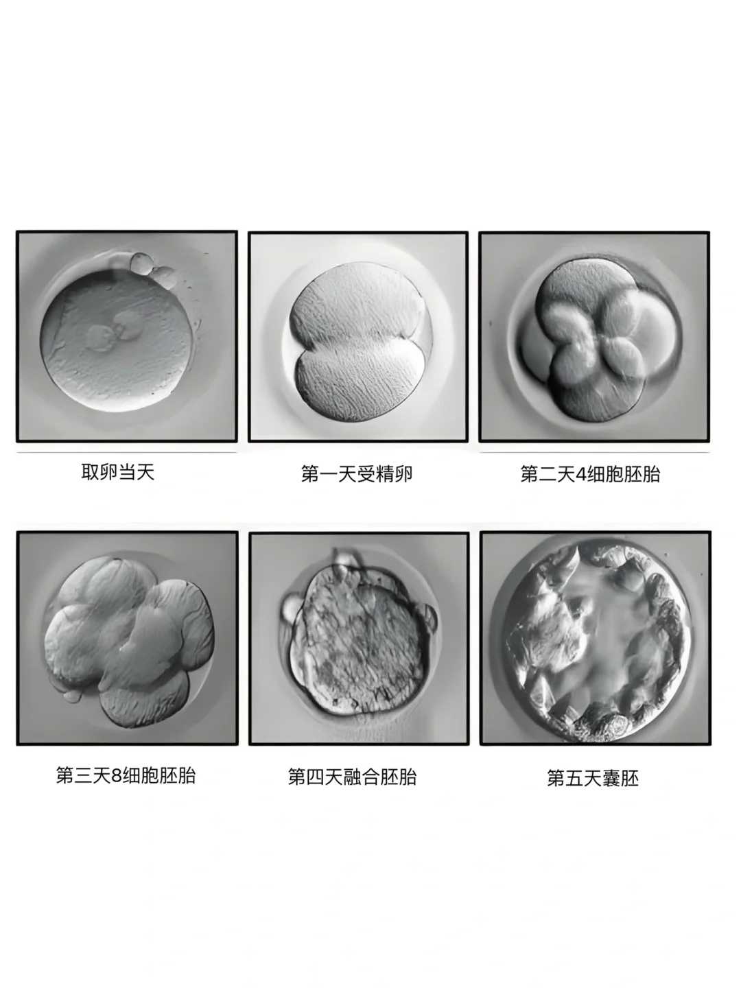 供卵代孕报价,疤痕子宫做试管怀双胞胎必须减胎清宫吗?