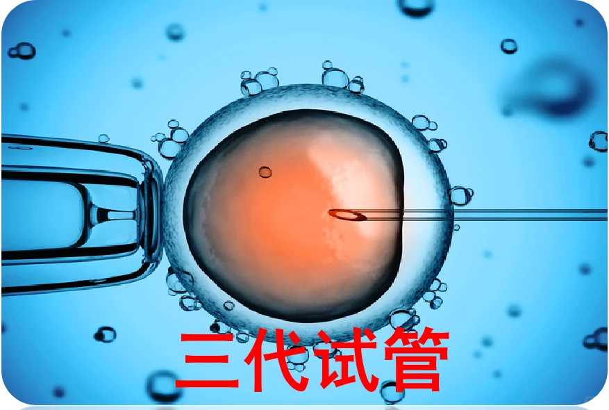 供卵试管婴儿品牌李广,广州供卵试管婴儿