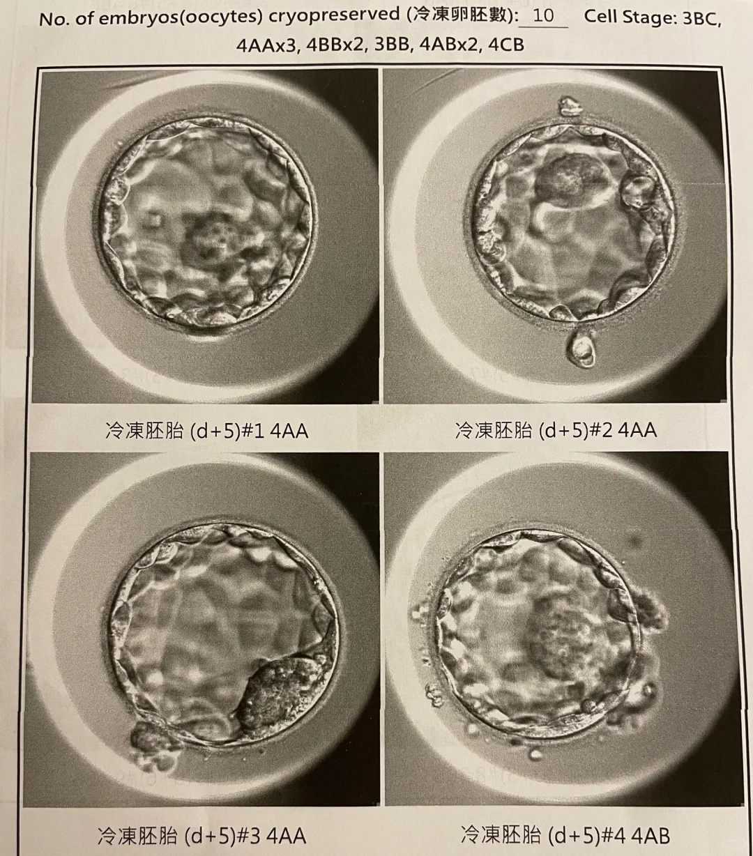 代孕孩子男孩,
              宫腔粘连每天用盐袋热敷真的有效吗？
            