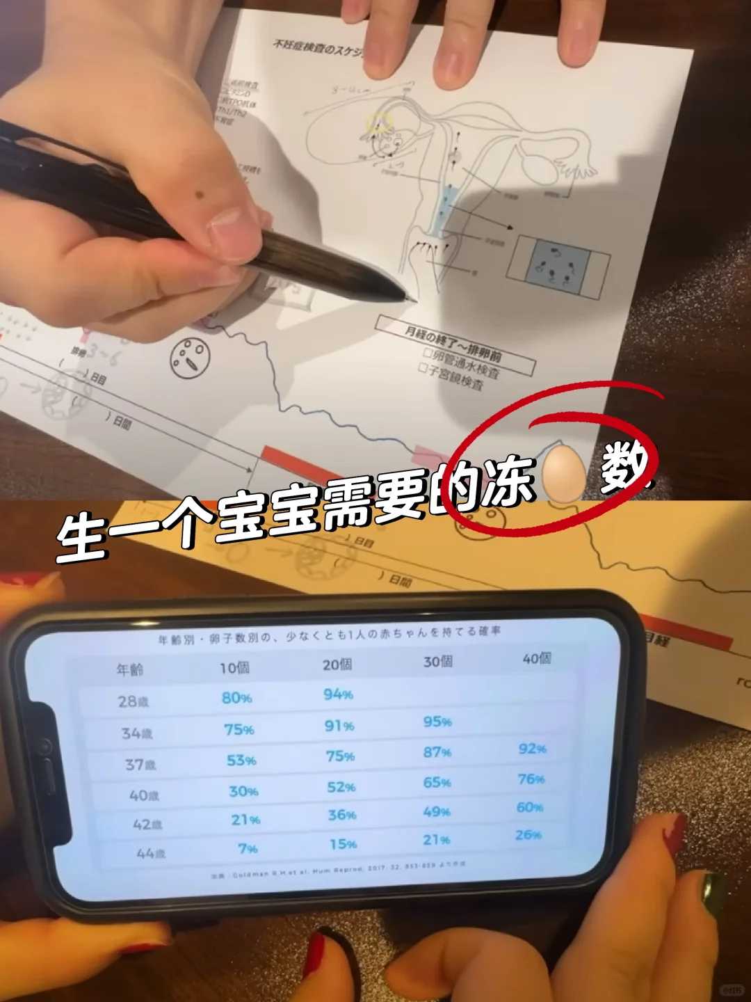 国内洗精术_哪里做代孕试管最好,染色体平衡易位对三代试管成功率有什么影响