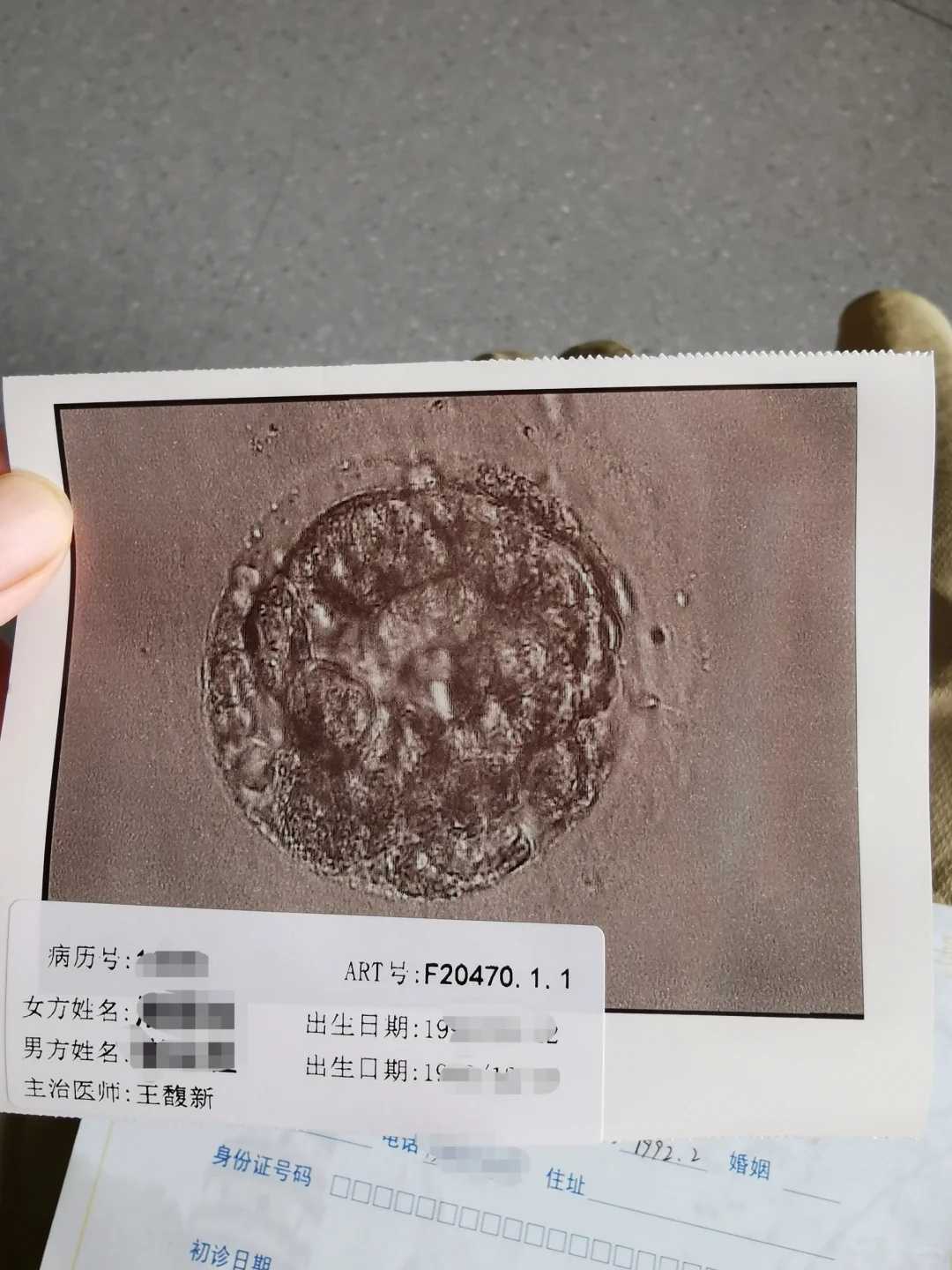 在广州私立医院做供卵试管的卵子是健康的吗?