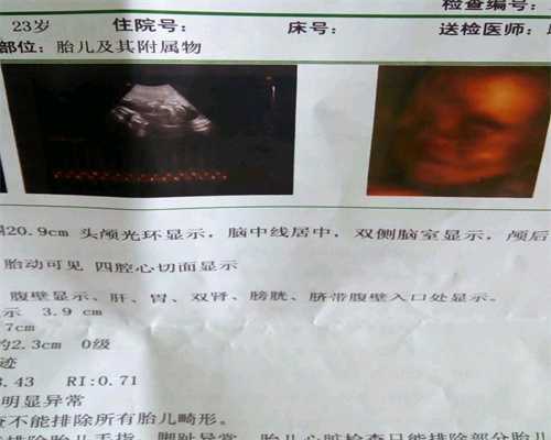 广州代怀孕机构这些症状暗示：你怀孕了