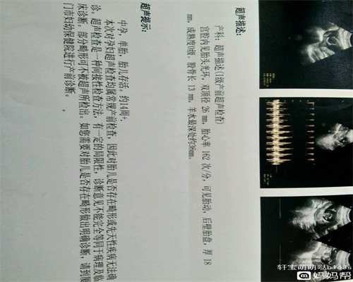 广州正规代孕第一次怀孕自然流产，下次怀孕需