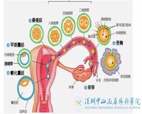 广州试管代孕费用老公不能生育，但我却代怀孕