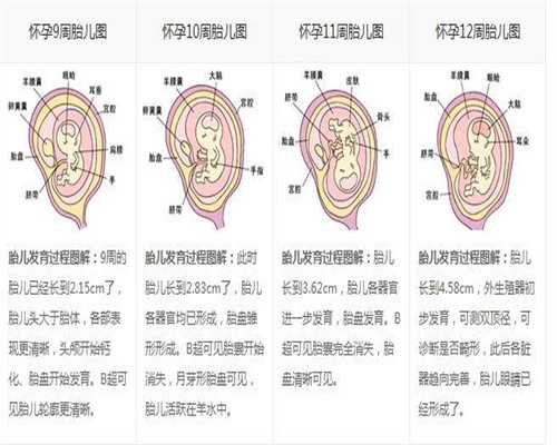 广州代孕机构代孕妇代怀孕初期感冒会出现哪些
