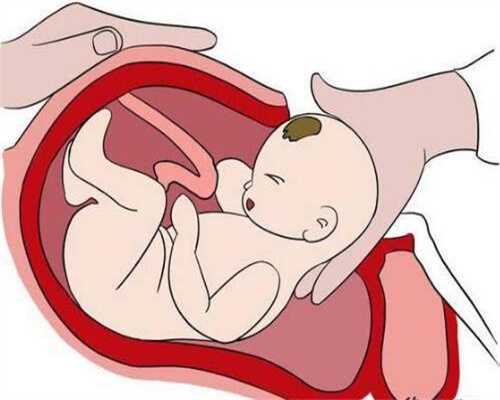 代孕的初期，胎儿停止发育多久会自然流掉？心