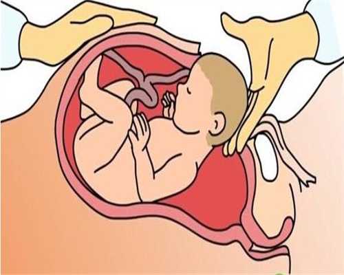 广州代孕哪里好：怀孕5个月，肚子有一半是硬邦