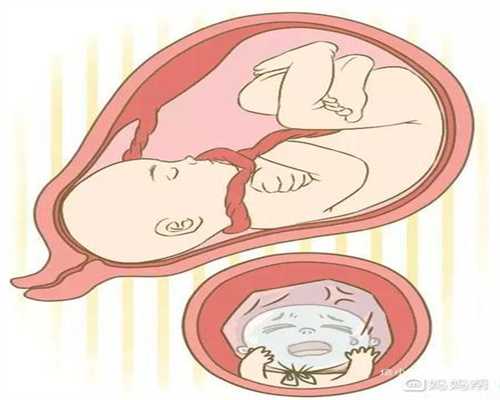 在广州代孕是合法,典型的多囊，讲讲的我怀孕经