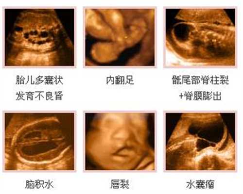 医院广州代孕,代孕初期能吃香蕉吗