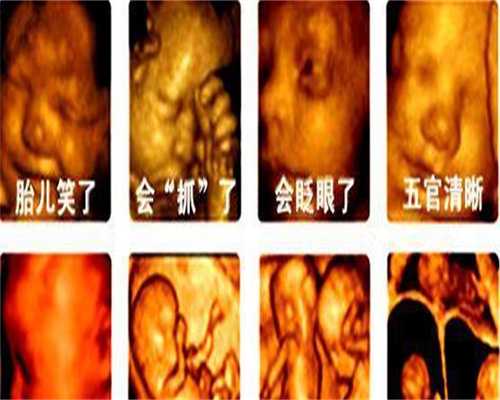 国内哪家医院可以做广州代孕,一代二代三代有什