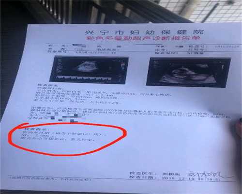 想找广州代孕,做试管婴儿，你需要先了解什么