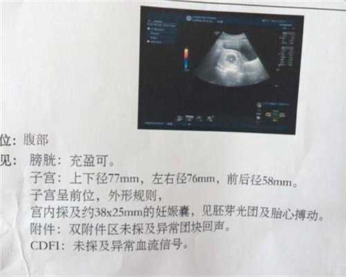 试管婴儿都有什么优势,浅谈子宫输卵管4D超声造