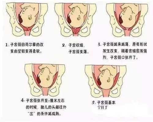 广州代孕中介靠谱吗,无腿女人做试管产下双胞胎