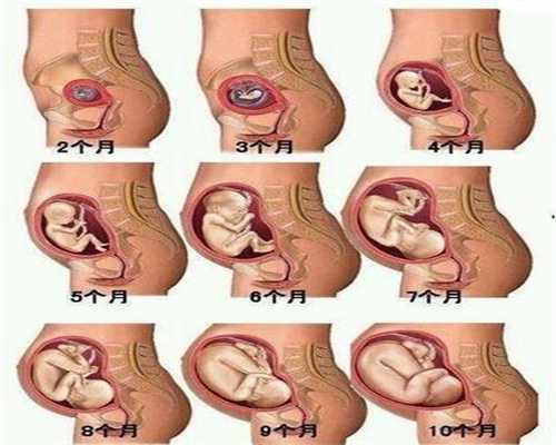 捐卵广州代孕妈妈,广州代孕全程价格,代怀孩子哪