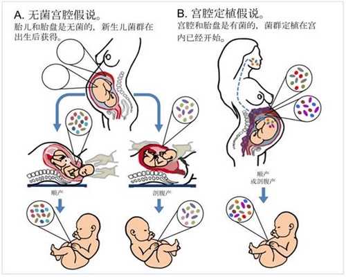 广州代孕费用高承受不起,第三代试管婴儿选男孩