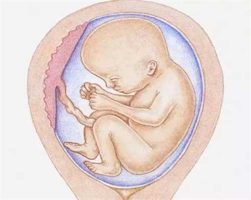 引发不孕的输卵管疾病有哪些