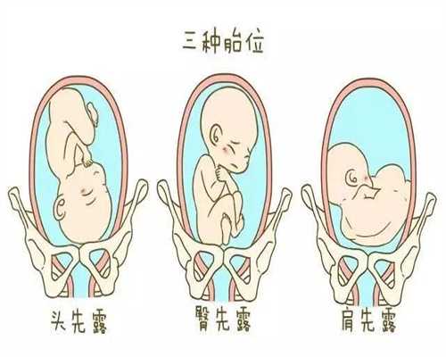 为什么有人网上找人广州代孕,想要怀孕但你的输