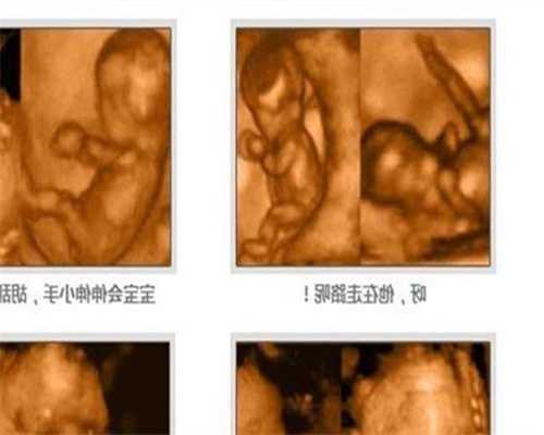 国内广州代孕机构价格 ,如何判断卵巢功能好不好