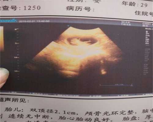 国内广州代孕哪家好,山西黄河患子宫肌瘤的十种