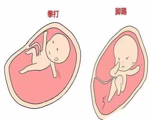 <b>孕早期为什么容易胎停育 胎停育可以预防吗</b>