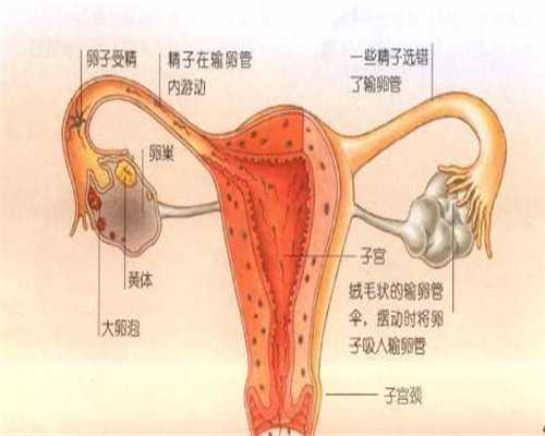 泉州借卵生子：有子宫腺肌症的女性如何预防流
