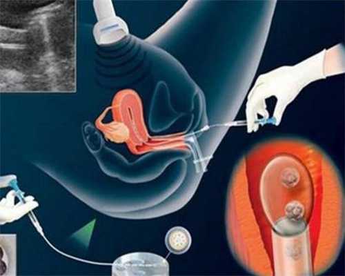 成都代孕中介：南昌女性输卵管检查项目有哪些