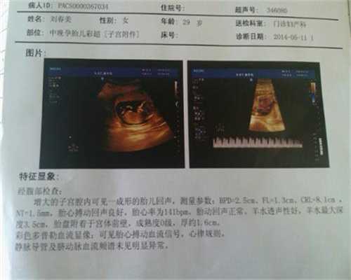 北京代孕医院,输卵管细长对怀孕有影响吗