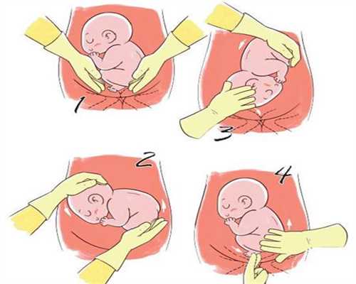 供卵试管孩子是谁的,月经期间应该如何进行保养