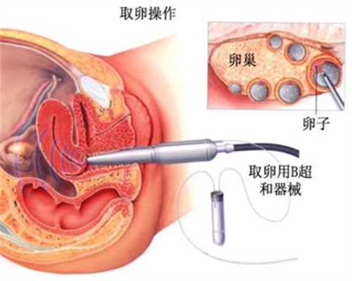 广州成功率最高的助孕机构,广州中药调理有助于