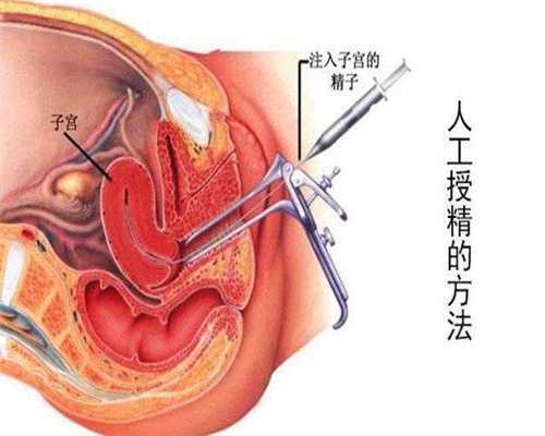 先天性卵巢发育不全综合症寿命_上海仁济试管成