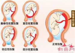 广州传承怀孕网_广州中国最权威的试管代孕医院