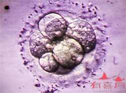 广州供卵代孕-广州哪里代孕-广州找代孕要好多钱