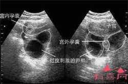 广州代孕-广州代孕产子的医院-广州捐卵代孕哪家好
