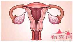 输卵管过长人工授精,国内大型助孕机构代孕拉肚子的饮食注意事项