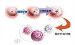 广州代孕-广州助孕的微博-广州单亲可以在代孕吗