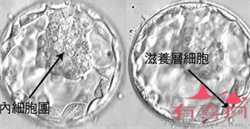 广州代孕中介-广州代孕是不是违法-广州知名代孕试管机构