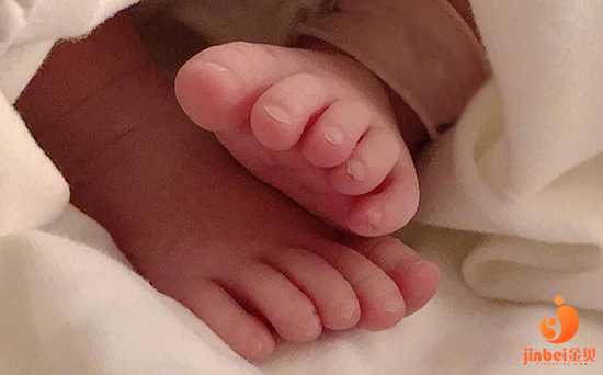 包男孩合肥助孕机构,【广州供卵机构包男孩】31周顺产女宝宝